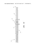 METHOD AND APPARATUS FOR SPINAL STABILIZATION diagram and image