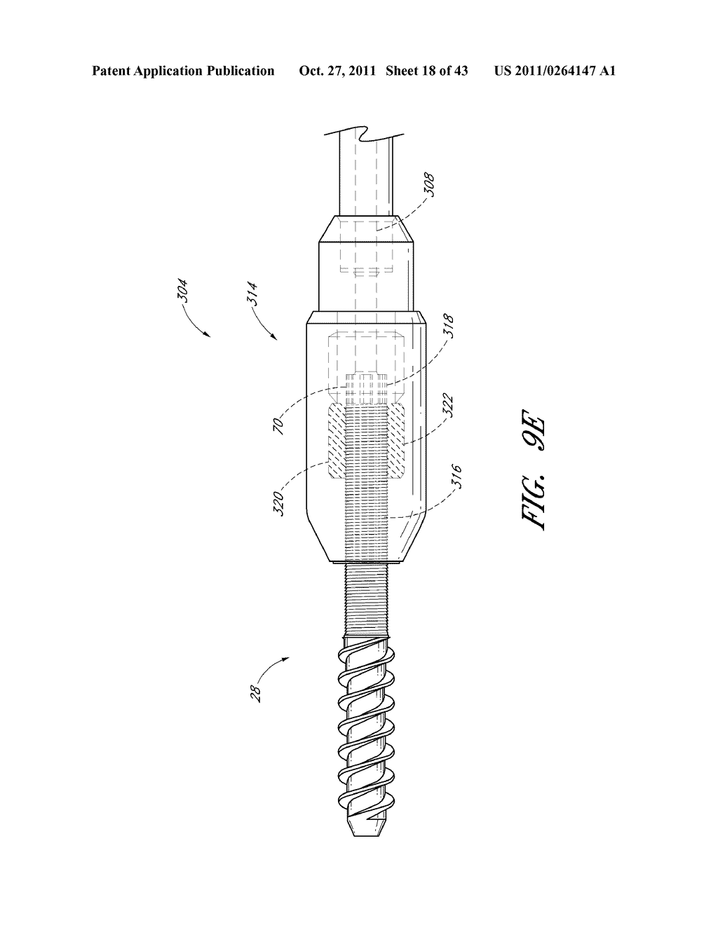 METHOD AND APPARATUS FOR SPINAL STABILIZATION - diagram, schematic, and image 19