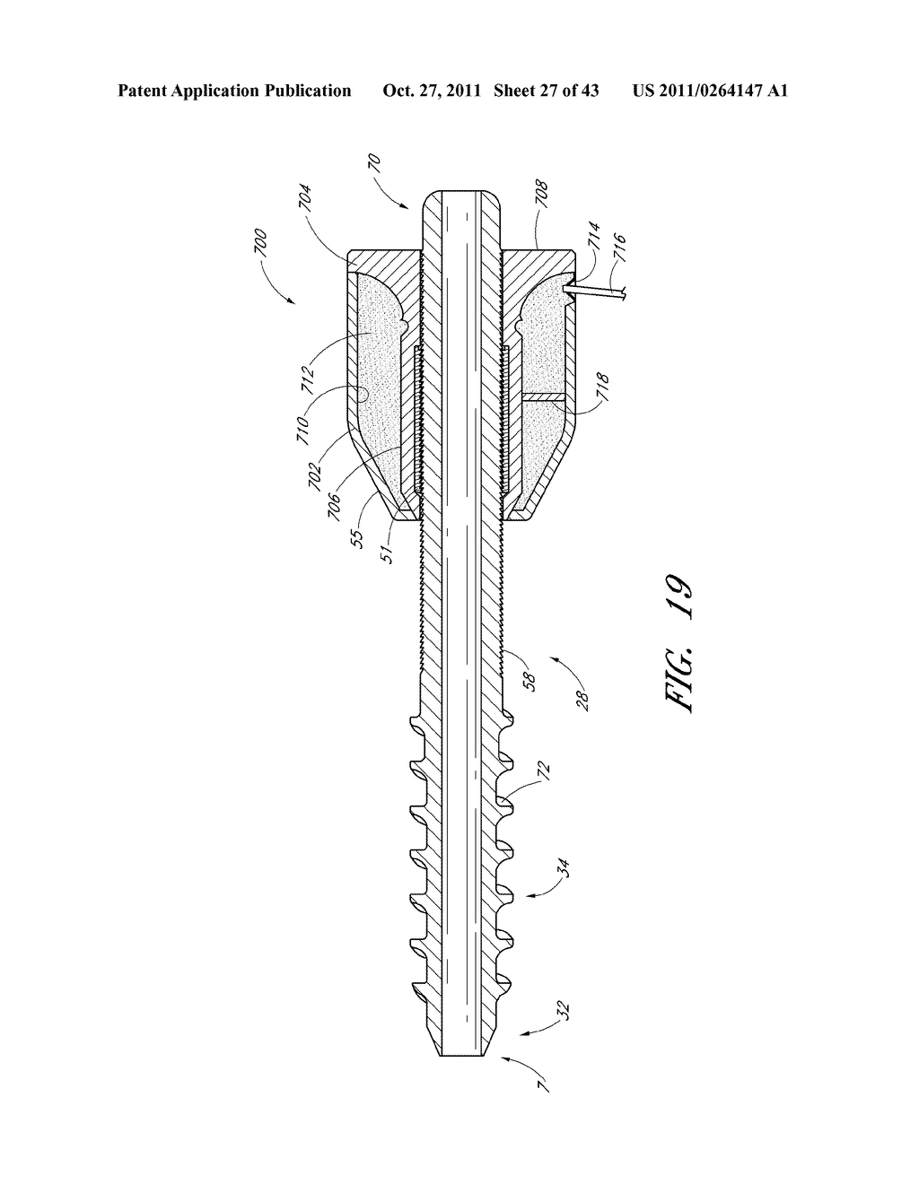 METHOD AND APPARATUS FOR SPINAL STABILIZATION - diagram, schematic, and image 28