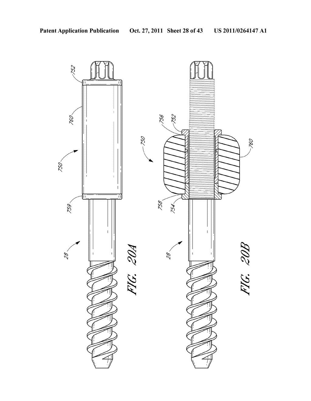 METHOD AND APPARATUS FOR SPINAL STABILIZATION - diagram, schematic, and image 29