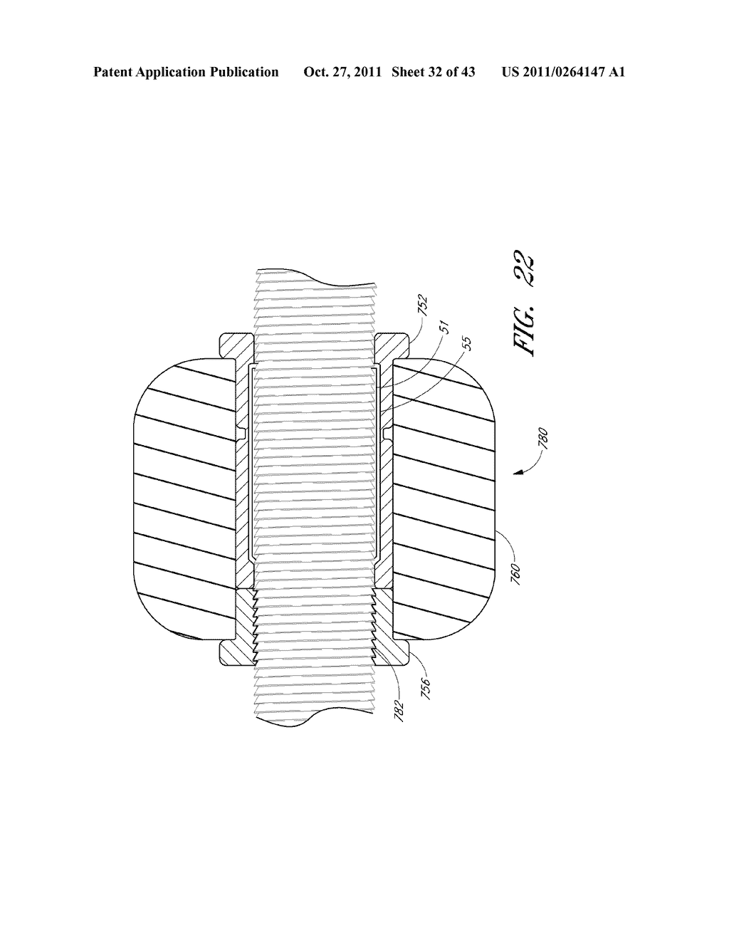 METHOD AND APPARATUS FOR SPINAL STABILIZATION - diagram, schematic, and image 33