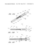 METHOD AND APPARATUS FOR SPINAL STABILIZATION diagram and image