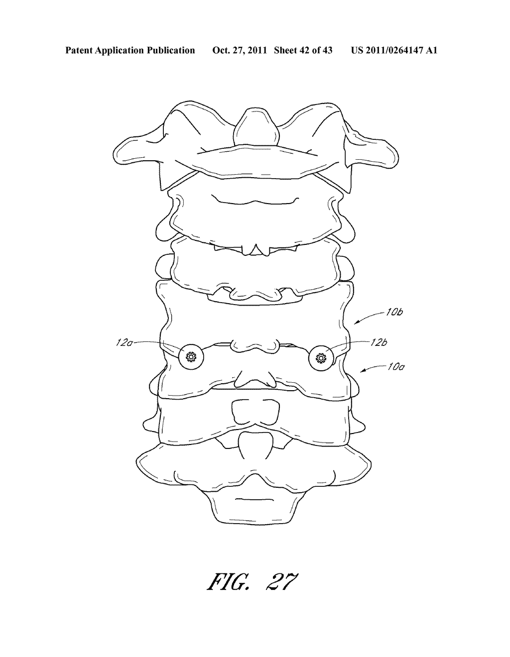 METHOD AND APPARATUS FOR SPINAL STABILIZATION - diagram, schematic, and image 43