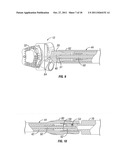 Insertion Tool Assembly diagram and image