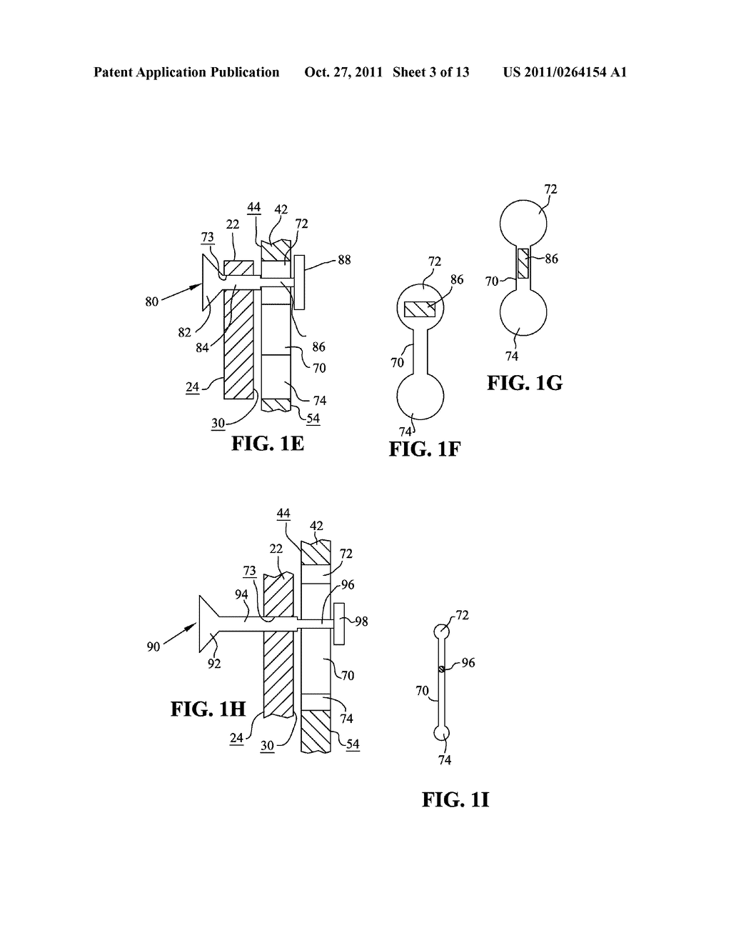 EXPANDABLE ARTHROPLASTY PLATES - diagram, schematic, and image 04