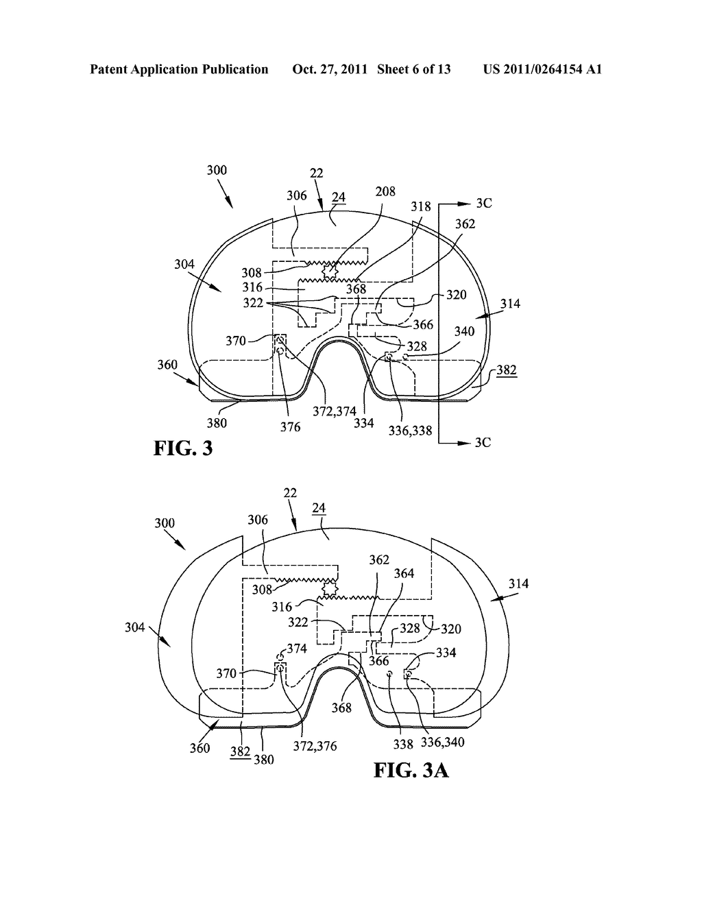 EXPANDABLE ARTHROPLASTY PLATES - diagram, schematic, and image 07