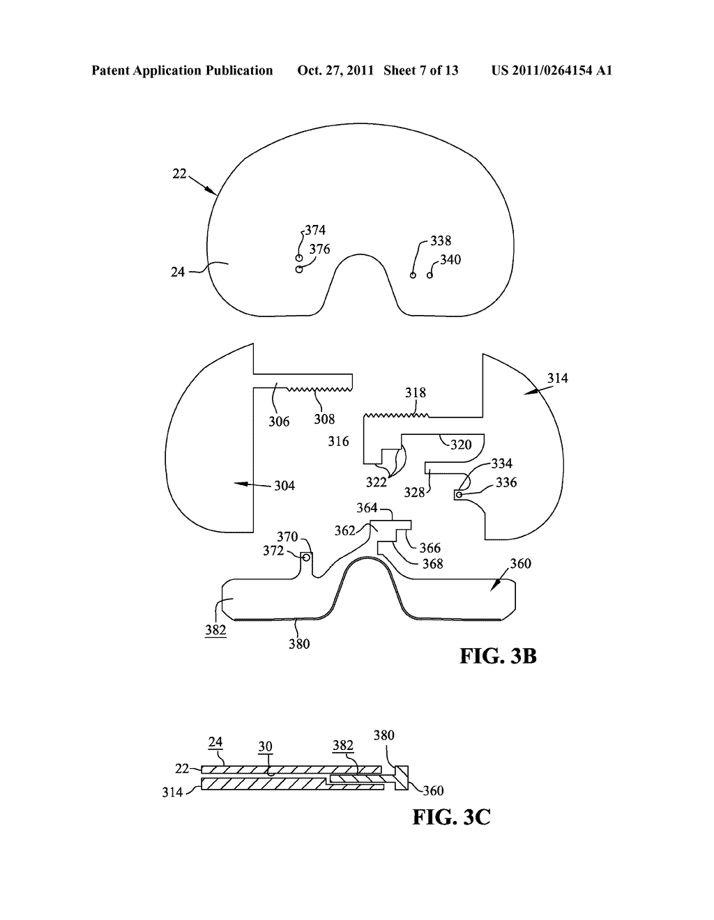 EXPANDABLE ARTHROPLASTY PLATES - diagram, schematic, and image 08