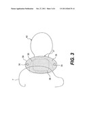 COCHLEAR IMPLANT COMPONENT HAVING A UNITARY FACEPLATE diagram and image