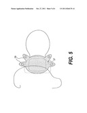 COCHLEAR IMPLANT COMPONENT HAVING A UNITARY FACEPLATE diagram and image