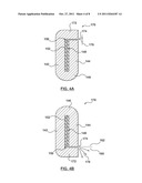 Drug Eluting Folded Stent and Stent Delivery System diagram and image