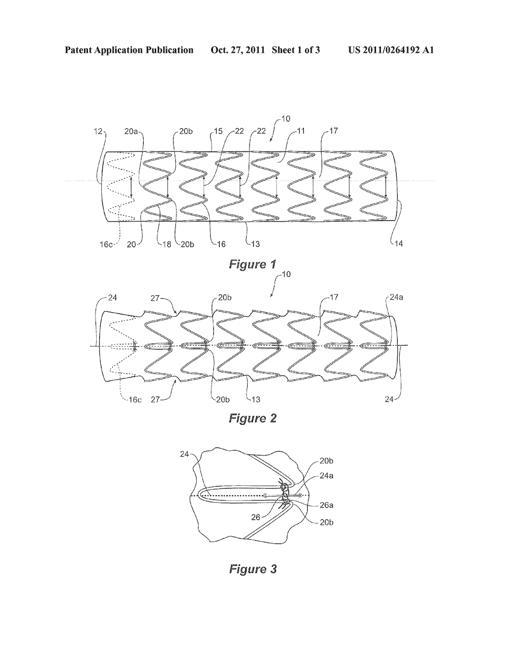 CURVE FORMING STENT GRAFT - diagram, schematic, and image 02