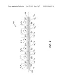 Helical Stent with Opposing and/or Alternating Pitch Angles diagram and image