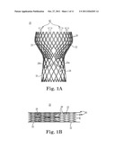 Transcatheter Prosthetic Heart Valve Delivery Device With Passive Trigger     Release diagram and image