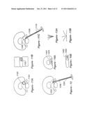 METHODS AND APPARATUS FOR TREATING DISC HERNIATION AND PREVENTING THE     EXTRUSION OF INTERBODY BONE GRAFT diagram and image