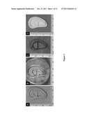 ENGINEERED CRANIOFACIAL CONSTRUCTS WITH COMPOSITE SCAFFOLD diagram and image