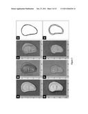 ENGINEERED CRANIOFACIAL CONSTRUCTS WITH COMPOSITE SCAFFOLD diagram and image