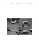 ENGINEERED CRANIOFACIAL CONSTRUCTS WITH COMPOSITE SCAFFOLD diagram and image