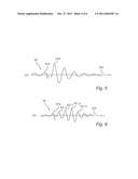 Method for determining the starting instant of a periodically oscillating     signal response diagram and image