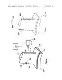 METHOD FOR REPAIRING AND/OR UPGRADING A COMPONENT OF A GAS TURBINE diagram and image