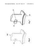 METHOD FOR REPAIRING AND/OR UPGRADING A COMPONENT OF A GAS TURBINE diagram and image