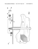 SYSTEM FOR OPTIMIZING A DRILLING OPERATION AND METHOD FOR USING SAME diagram and image