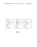 REPRESENTATION OF OVERLAPPING VISUAL ENTITIES diagram and image