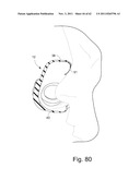 RESPIRATORY MASK diagram and image