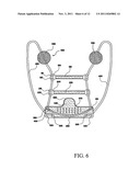 DEVICE FOR PREVENTING MOUTH OPENING DURING SLEEP diagram and image