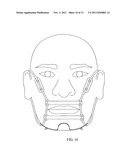 DEVICE FOR PREVENTING MOUTH OPENING DURING SLEEP diagram and image