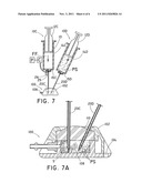 METHOD AND SYSTEM FOR CLEANING FLUID RESERVOIR OF VASCULAR ACCESS DEVICE diagram and image