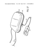 Sealed Manifold For Air Pump System diagram and image