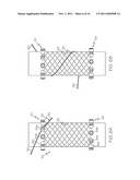 APPARATUS AND METHOD FOR MANUFACTURING A SINGLE WIRE STENT diagram and image