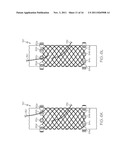 APPARATUS AND METHOD FOR MANUFACTURING A SINGLE WIRE STENT diagram and image