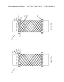 APPARATUS AND METHOD FOR MANUFACTURING A SINGLE WIRE STENT diagram and image