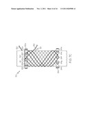 APPARATUS AND METHOD FOR MANUFACTURING A SINGLE WIRE STENT diagram and image