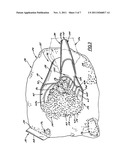 Sifting Scoop diagram and image