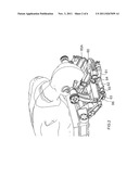 RF COIL ASSEMBLY FOR USE IN MAGNETIC RESONANCE IMAGING diagram and image