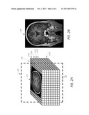 SYSTEMS AND METHODS FOR VIEWING MEDICAL 3D IMAGING VOLUMES diagram and image