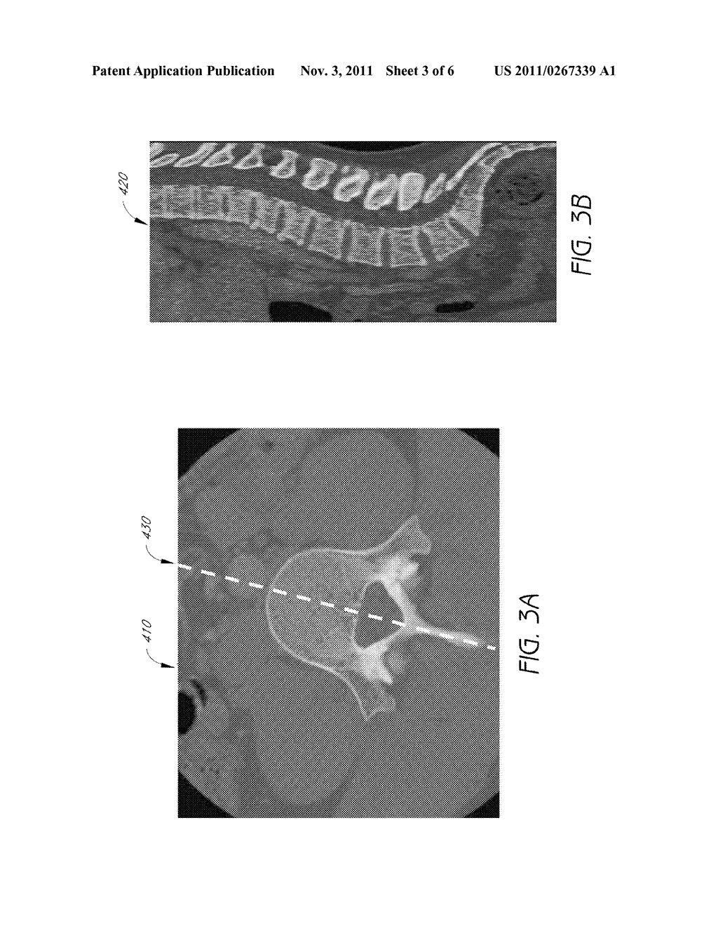 SYSTEMS AND METHODS FOR VIEWING MEDICAL 3D IMAGING VOLUMES - diagram, schematic, and image 04