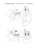 GRAPHITE ELECTRODE WITH AN ELECTRICAL CONNECTING ELEMENT diagram and image