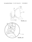 System and Method for Placing and Determining an Appropriately Sized     Surgical Implant diagram and image