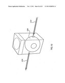 ORTHOVOLTAGE RADIOTHERAPY diagram and image