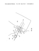 ORTHOVOLTAGE RADIOTHERAPY diagram and image