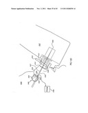 ORTHOVOLTAGE RADIOTHERAPY diagram and image