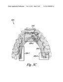 VIRTUAL CEPHALOMETRIC IMAGING diagram and image