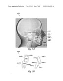 VIRTUAL CEPHALOMETRIC IMAGING diagram and image