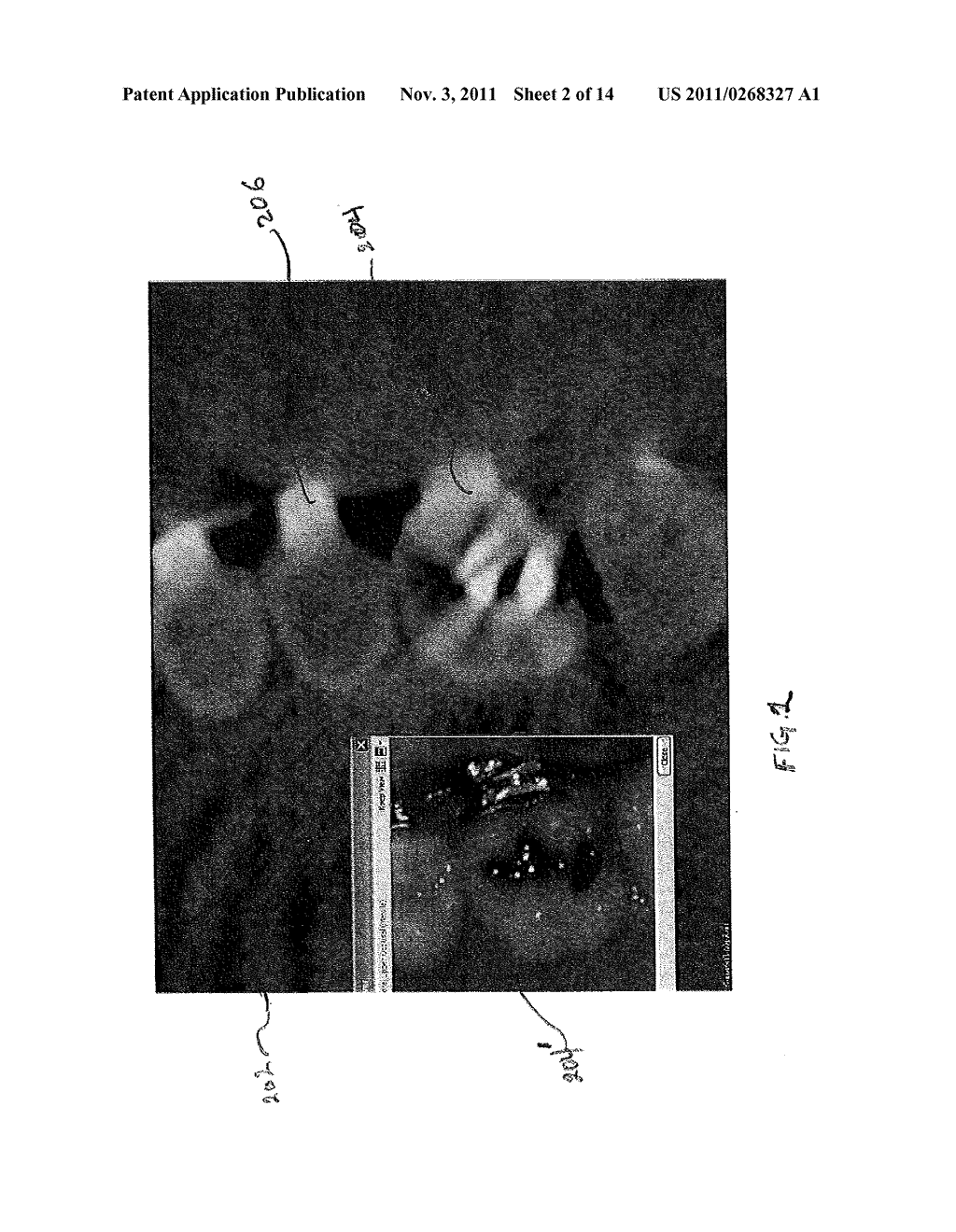 GENERATING THREE DIMENSIONAL DIGITAL DENTION MODELS FROM SURFACE AND     VOLUME SCAN DATA - diagram, schematic, and image 03