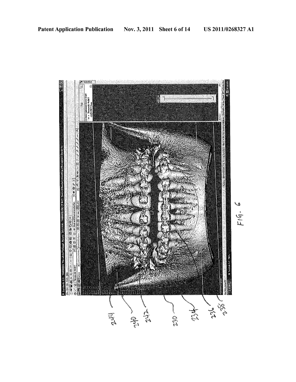 GENERATING THREE DIMENSIONAL DIGITAL DENTION MODELS FROM SURFACE AND     VOLUME SCAN DATA - diagram, schematic, and image 07