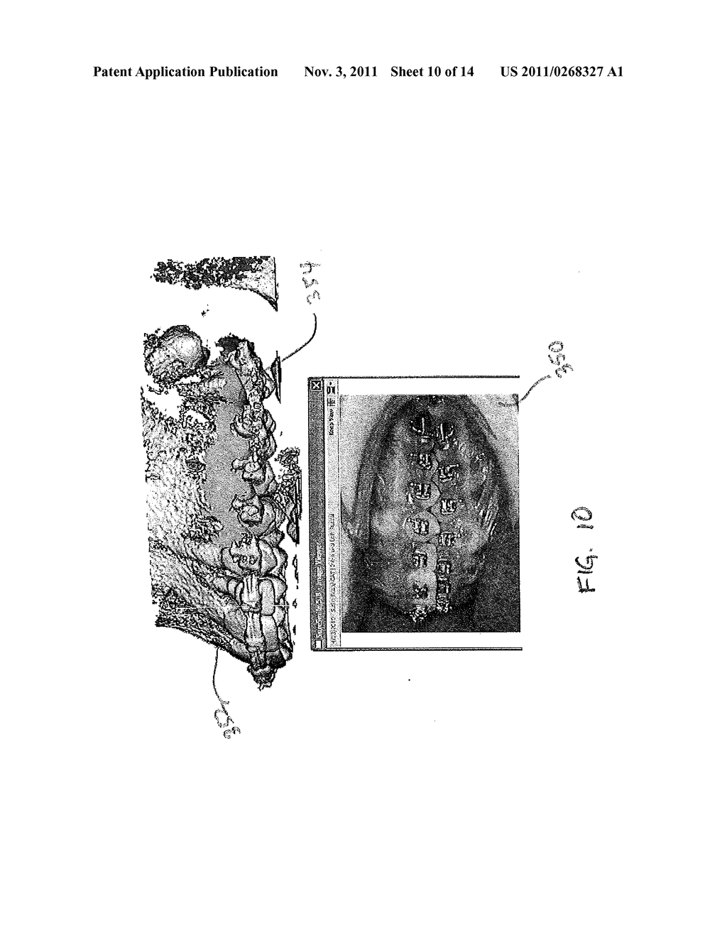 GENERATING THREE DIMENSIONAL DIGITAL DENTION MODELS FROM SURFACE AND     VOLUME SCAN DATA - diagram, schematic, and image 11