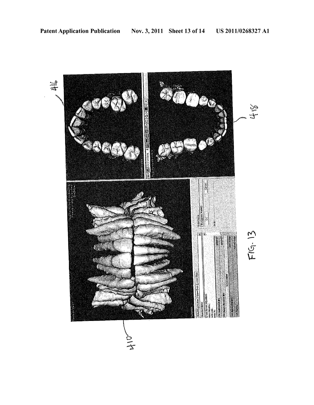 GENERATING THREE DIMENSIONAL DIGITAL DENTION MODELS FROM SURFACE AND     VOLUME SCAN DATA - diagram, schematic, and image 14